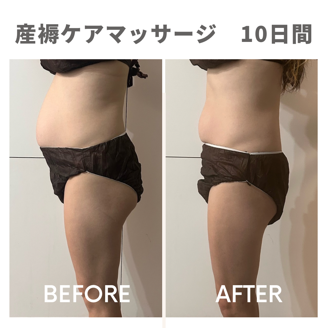 産褥ケア10日間：体型ビフォーアフター